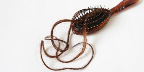 7_causes_de_la_perte_des_cheveux_chez_les_femmes